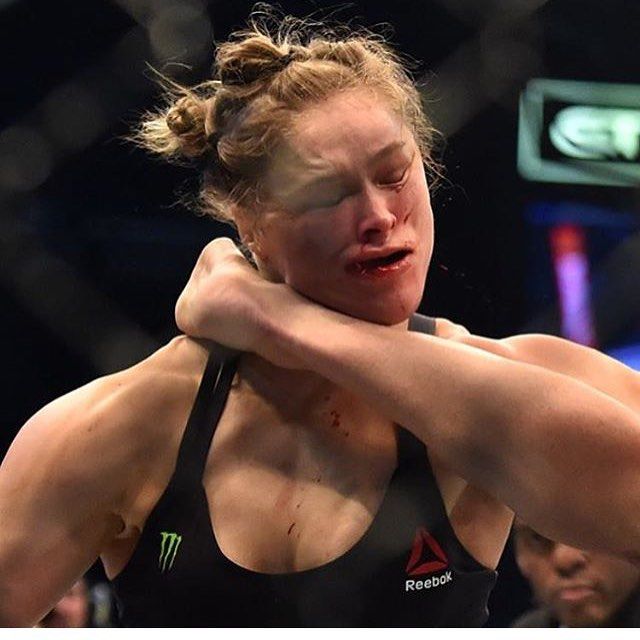 Ronda Rousey finger nearly completely severed. This is gross. Still image  of nastiness. You've been warned! - Eric Zane Show